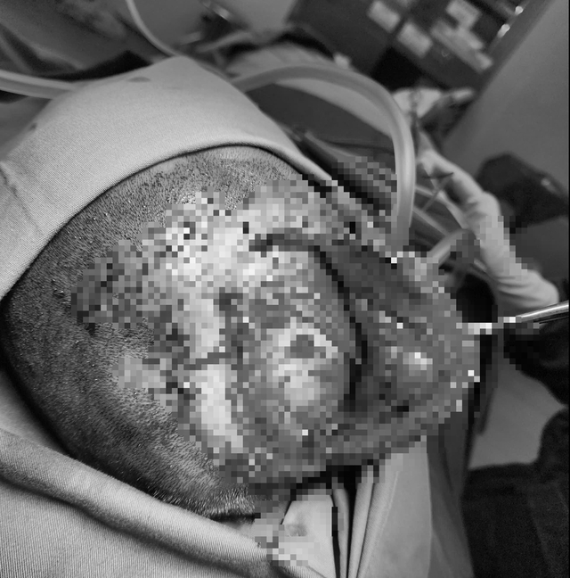 Vụ nhiều người thương vong sau tai nạn trên cao tốc: Tình trạng sức khỏe các nạn nhân hiện ra sao?- Ảnh 1.